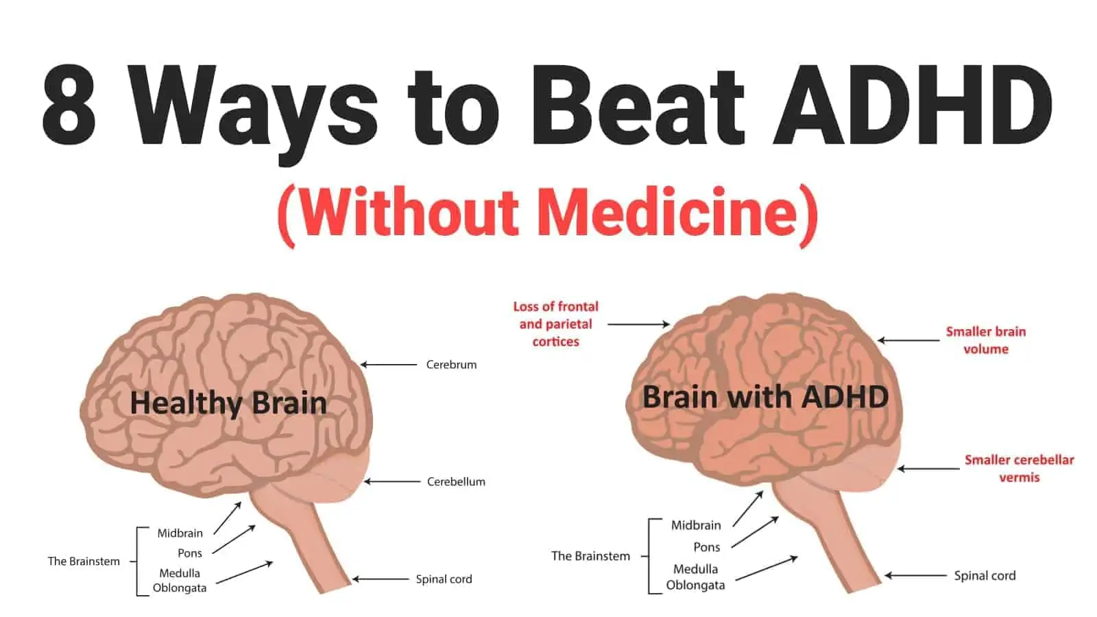 How to Focus with ADHD Without Medication